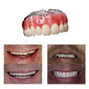 Dentadura de Silicone FIX | Ajustavel e Adaptativa