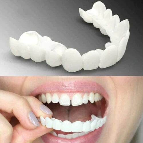 Facetas Odontológicas Removíveis